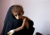 Yemen Calls upon International Humanitarian Organizations to Intervene to Save Civilians, IDPs