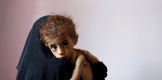 Yemen Calls upon International Humanitarian Organizations to Intervene to Save Civilians, IDPs