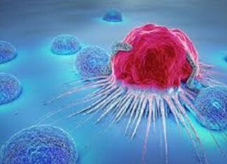 WIDESPREAD OF CANCER IN GILGIT BALTISTAN BLOWS THE WHISTLE FOR HEALTH AUTHORITIES
